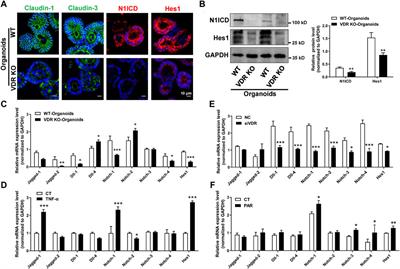 Vitamin D/vitamin D receptor protects intestinal barrier against colitis by positively regulating Notch pathway